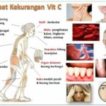 Tanda-Tanda Kekurangan Vitamin C-Pengedar Shaklee Penang