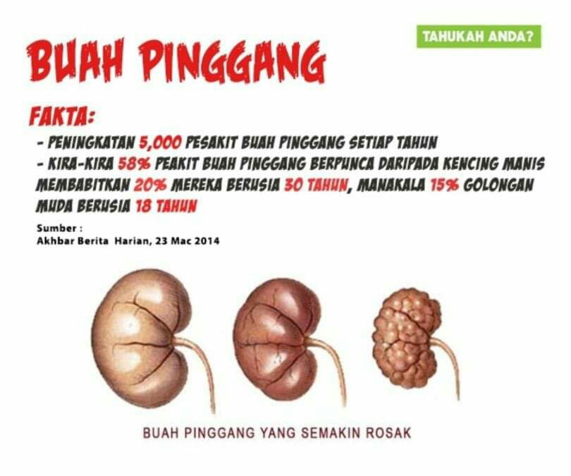 Tanda Awal Penyakit Buah Pinggang