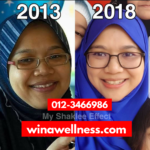 Testimoni Kulit Cantik Dan Flawless Selepas Konsisten Amalkan Shaklee