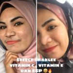 Vitamin E Shaklee Untuk Kulit Cantik